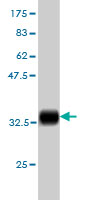 WB - S100A6 Antibody (monoclonal) (M16) AT3760a